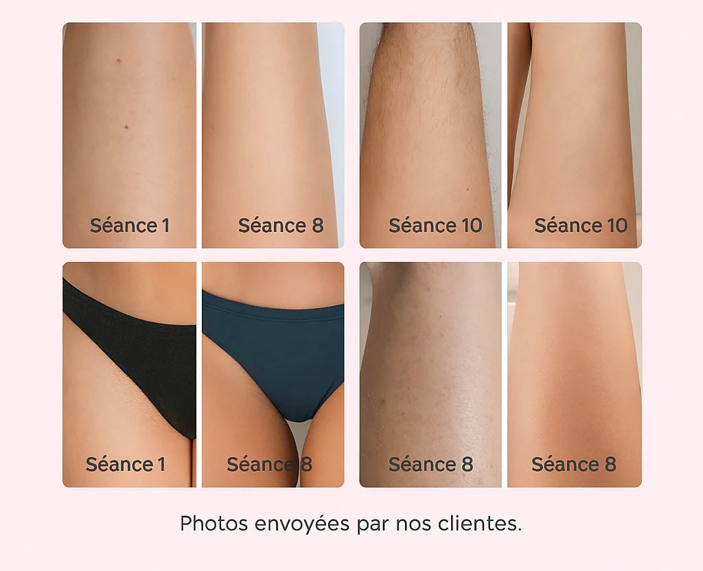 IPL Pulse • Pack Épilation : Exfoliant, Épilation Définitive & Hydratation