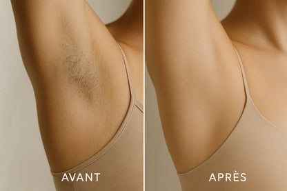 IPL Pulse • Pack Épilation : Exfoliant, Épilation Définitive & Hydratation